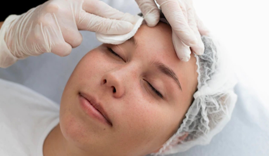 مراقبت های پس از کاشت ابرو