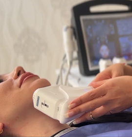 ویدئو مراحل هایفو صورت